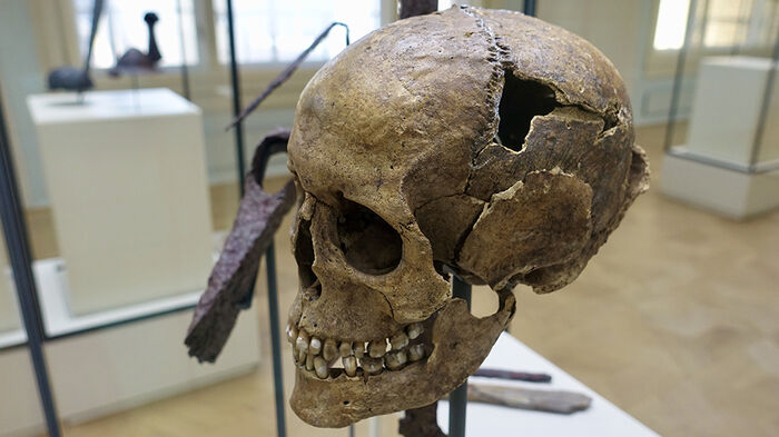 Hodeskalle med skader som er utstilt på et museum. Foto.